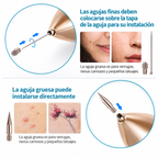 Lápiz de Plasma Láser Profesional - Removedor de Imperfecciones ⚡✨