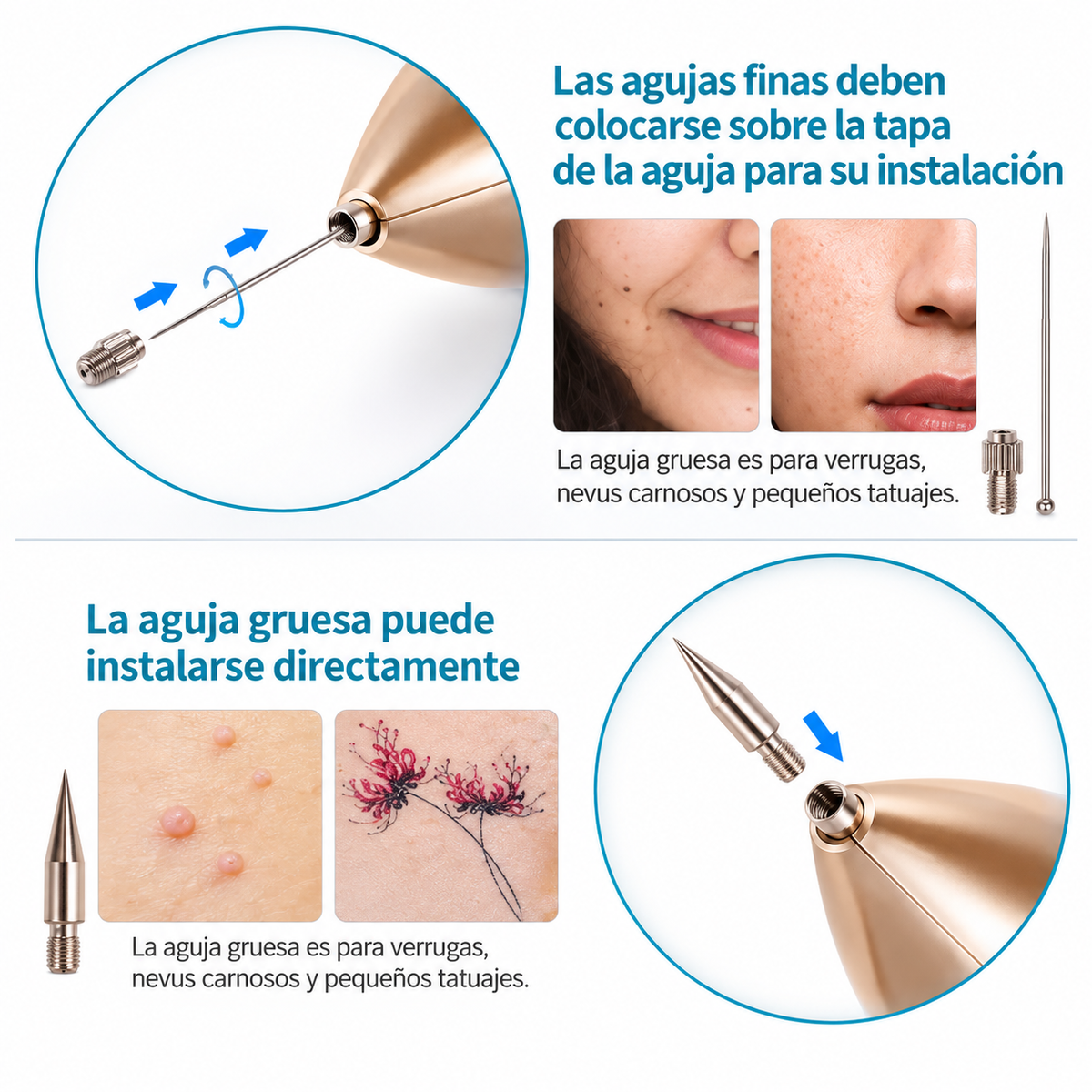 Lápiz de Plasma Láser Profesional - Removedor de Imperfecciones ⚡✨